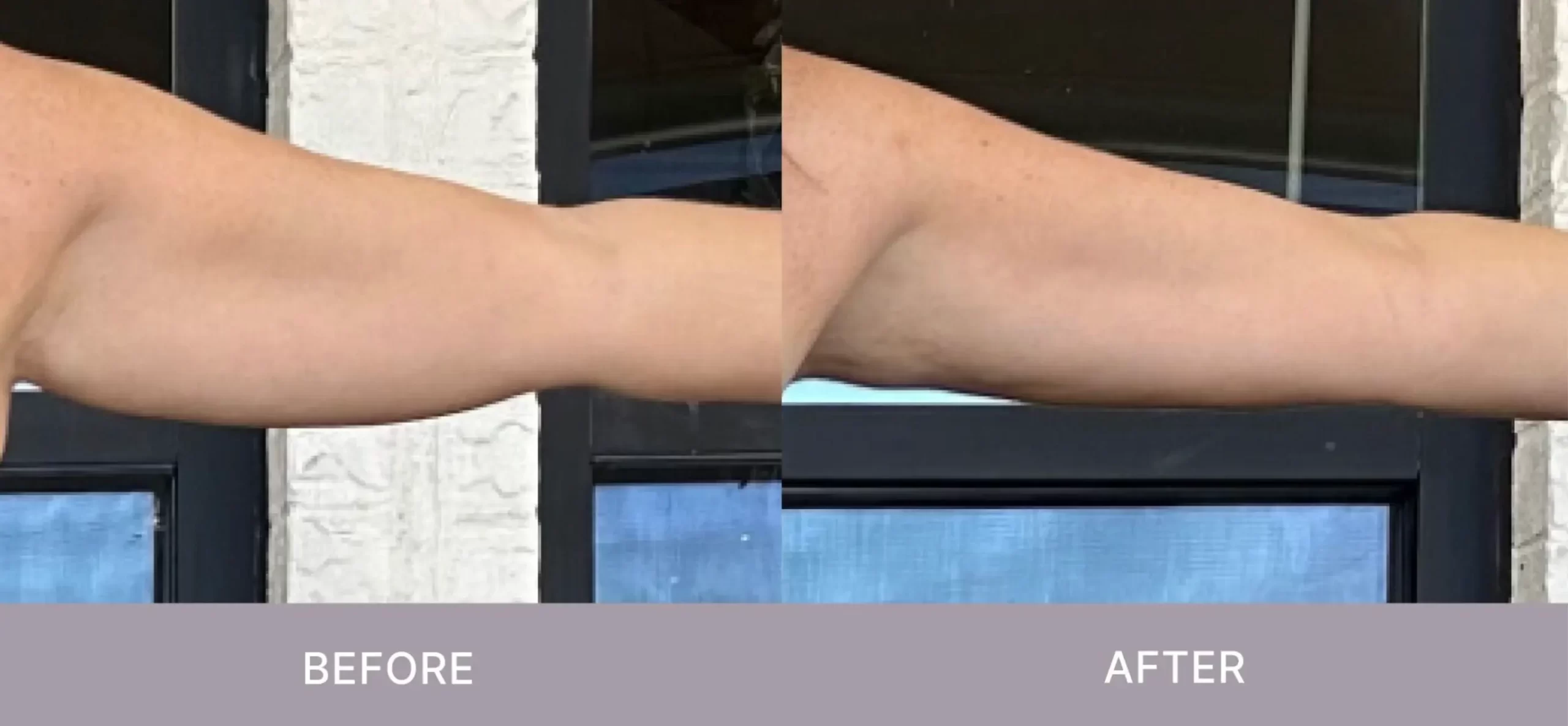 Nu Skin RenuSpa iO Nu Skin RenuSpa iO PRICE