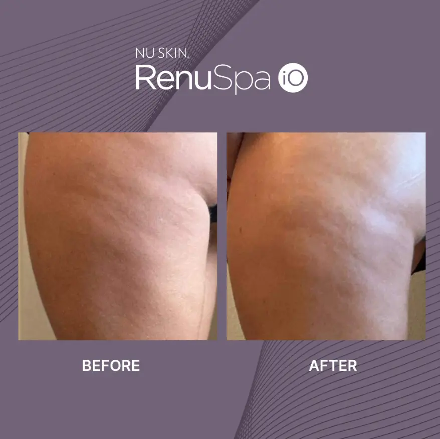 Nu Skin RenuSpa iO Nu Skin RenuSpa iO PRICE