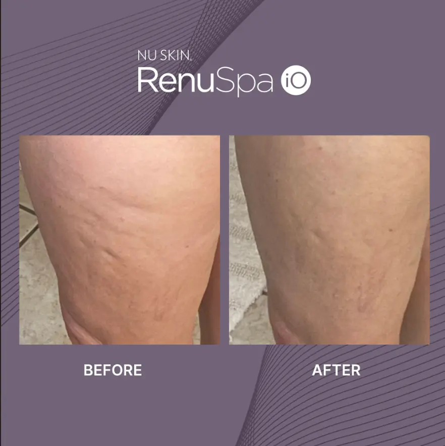 Nu Skin RenuSpa iO Nu Skin RenuSpa iO PRICE