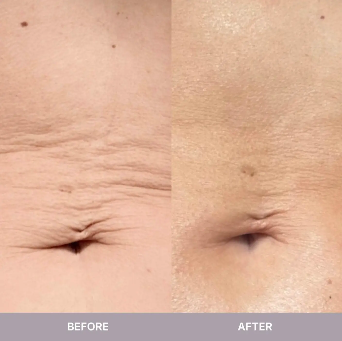 Nu Skin RenuSpa iO Nu Skin RenuSpa iO PRICE